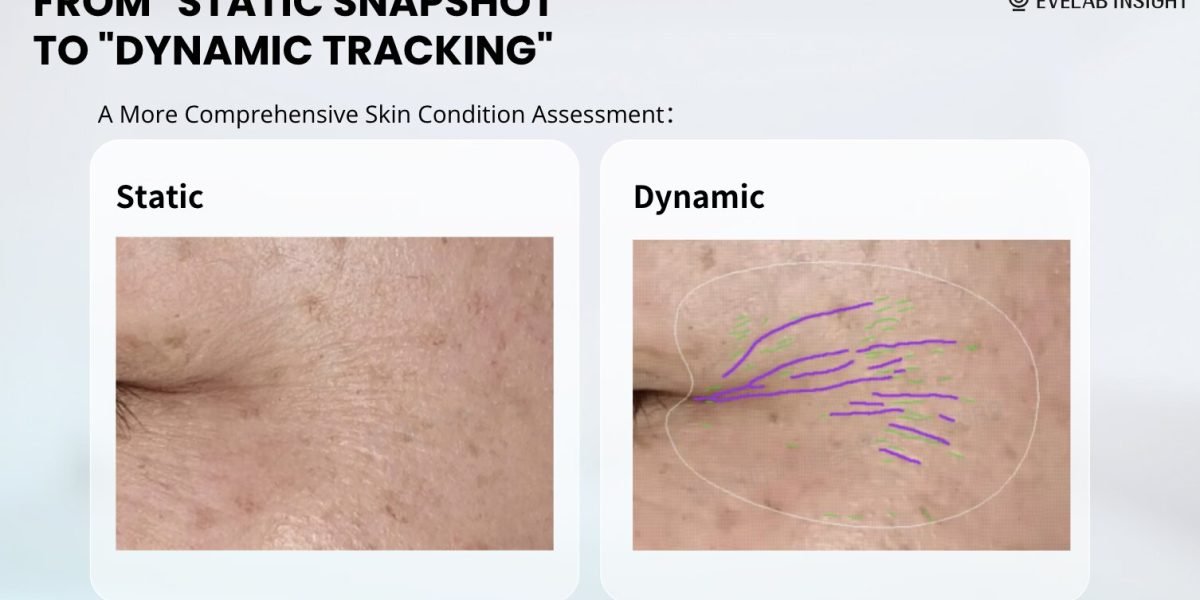 EveLab Insight Debuts Dynamic Wrinkle Detection Technology at VivaTech 2025, Shaping the Future of AI-Powered Skin Wellness