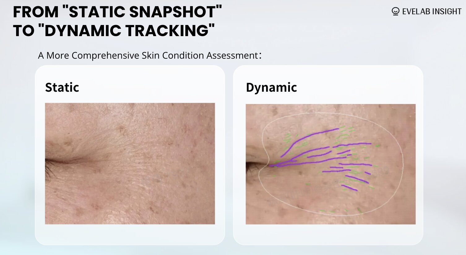 EveLab Insight Debuts Dynamic Wrinkle Detection Technology at VivaTech 2025, Shaping the Future of AI-Powered Skin Wellness