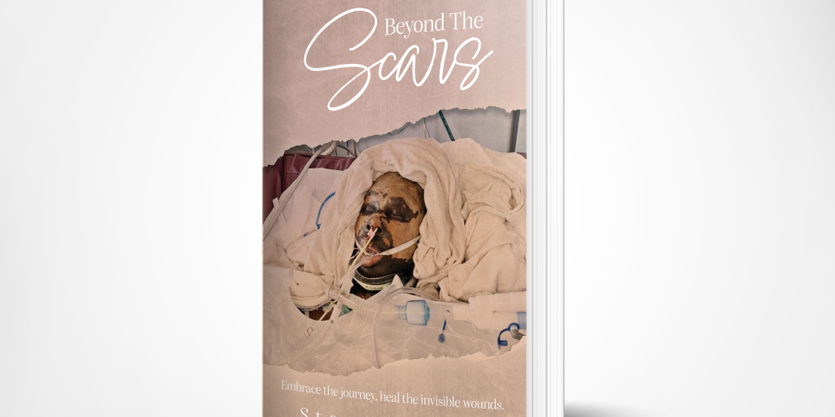 Transform Your Life After Trauma: A Guide to Healing and Resilience