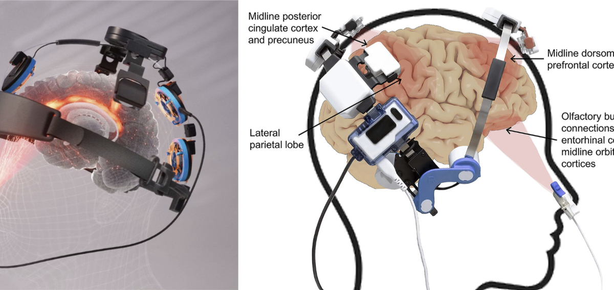 Protecting Football Players’ Brains: Breakthrough Study Reinforces Vielight’s Red-Light Therapy Technology