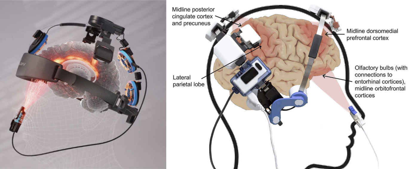 Protecting Football Players’ Brains: Breakthrough Study Reinforces Vielight’s Red-Light Therapy Technology