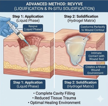 Kane Biotech Presents revyve® Clinical Data at Symposium on Advanced Wound Care (SAWC) Spring Conference